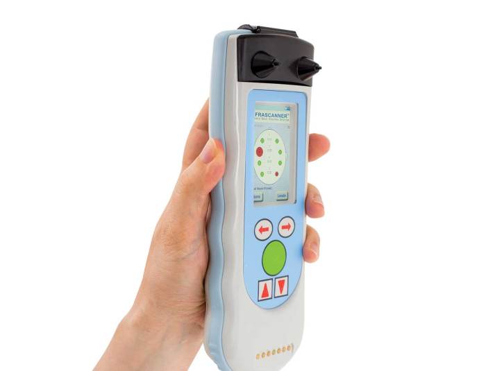 Infrascanner 2000 does rapid ct screening